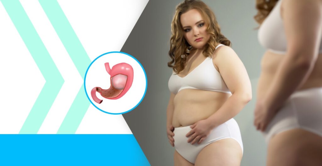 Gastric balloon