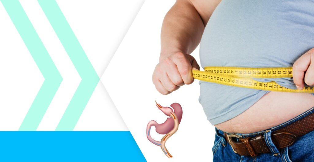 Gastric Bypass