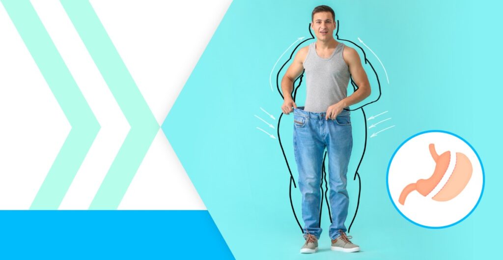 Sleeve Gastrectomy