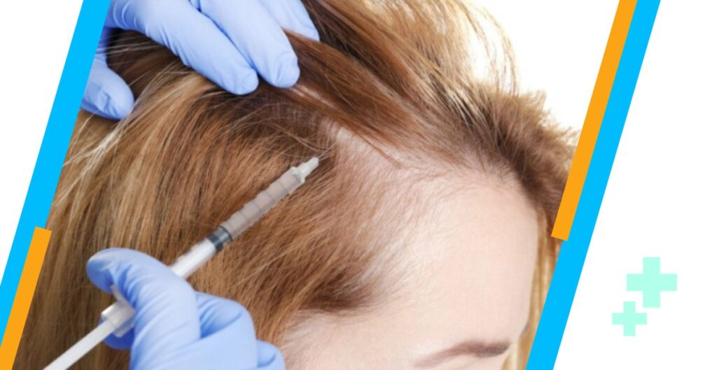 Hair Transplantation For Women