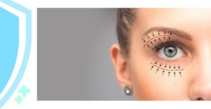 Eyelid Tightening